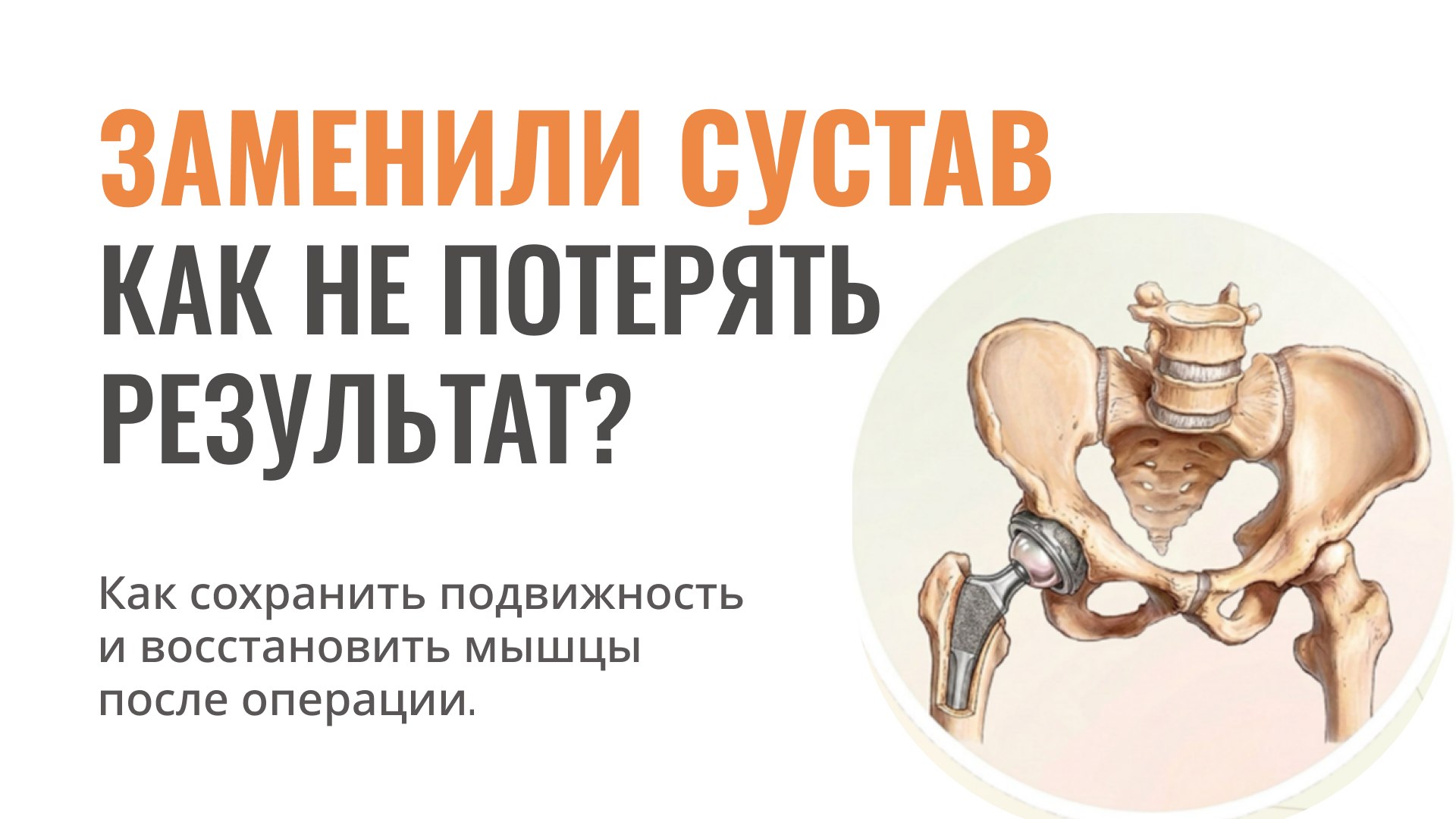Восстановление после протеза ТБС