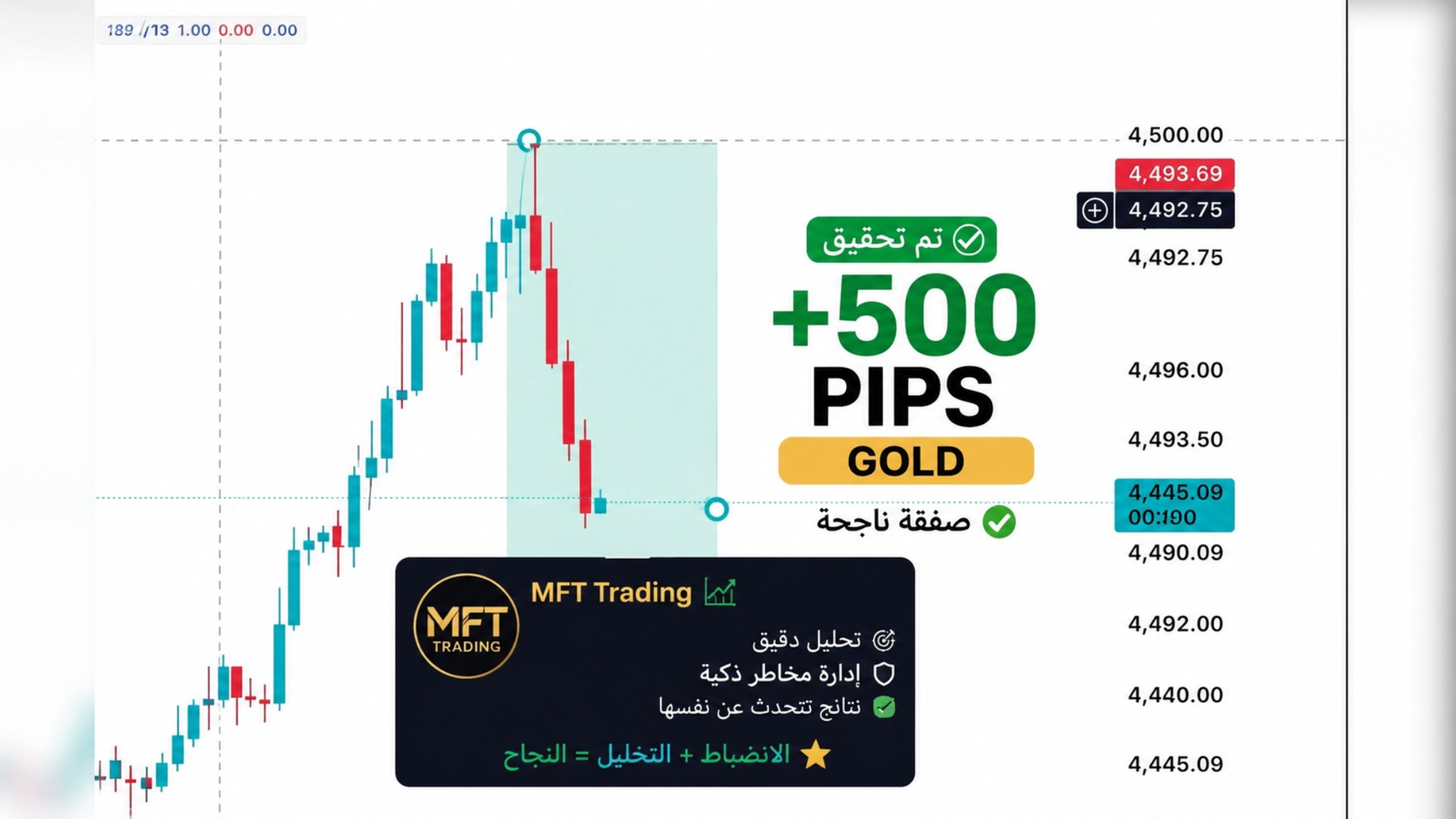 MFT 📈 (public)