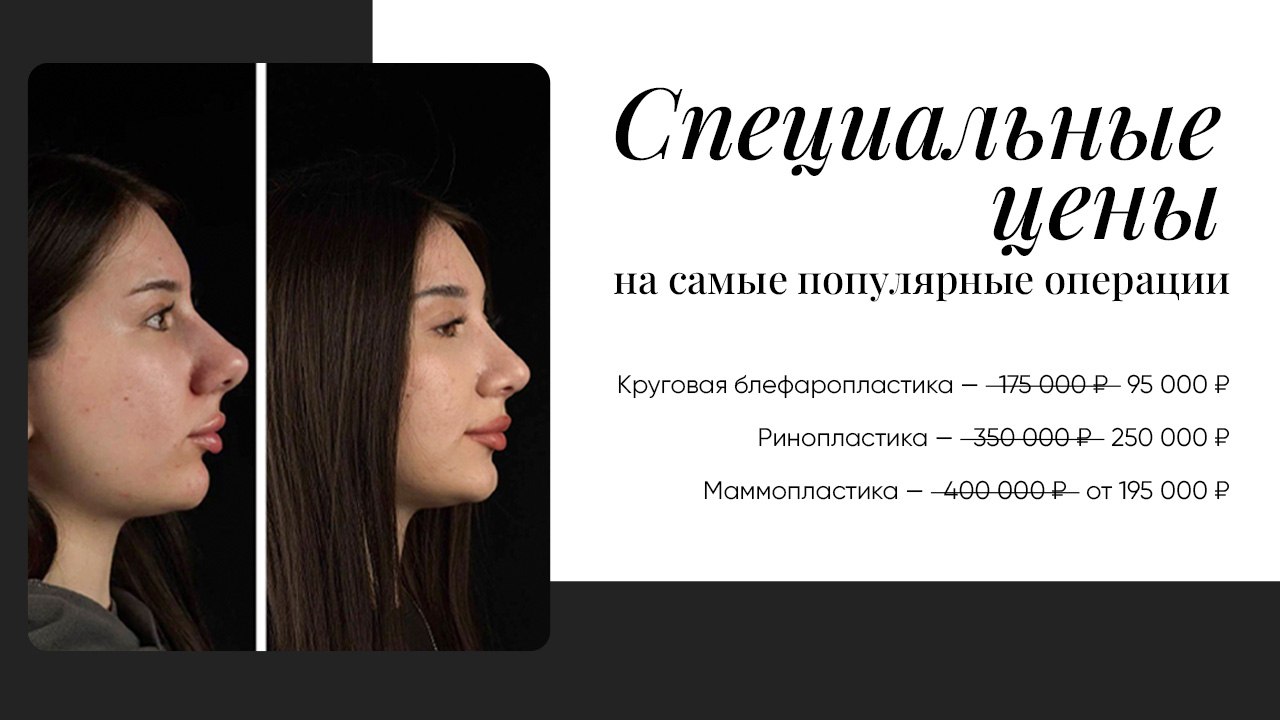 Ринопластика • Блефаропластика • Маммопластика • Беликов
